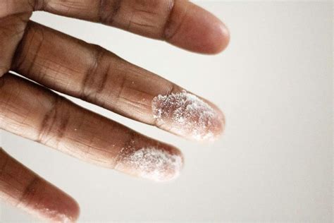 5 Talcum Powder Alternatives | MedTruth - Prescription Drug & Medical Device Safety | Informed ...