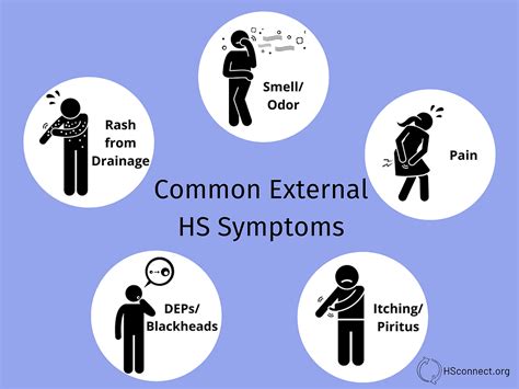 Common External HS Symptoms