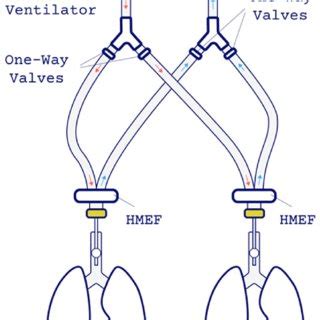 Measurement of the total PEEP on the ventilator, in circuit A and B and... | Download Scientific ...