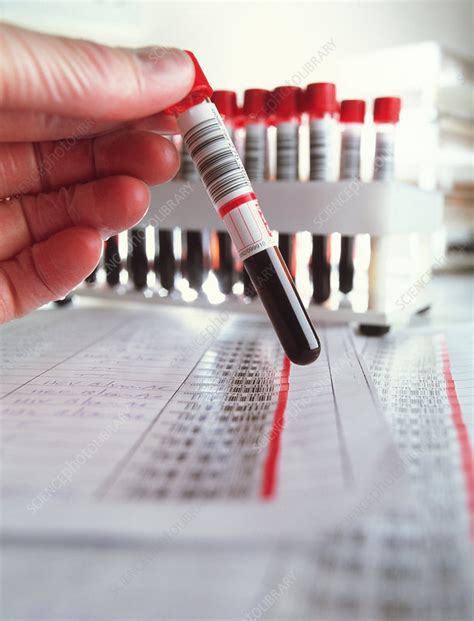 Blood samples - Stock Image - M530/0401 - Science Photo Library