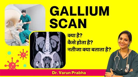 Gallium Scan Procedure | Gallium Scan Test कैसे होता है? - YouTube