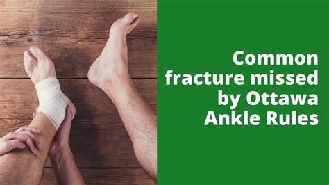 Common fracture missed by Ottawa Ankle Rules - YouTube