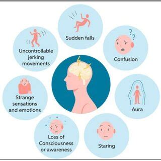 Symptoms of epileptic seizure [23]. | Download Scientific Diagram