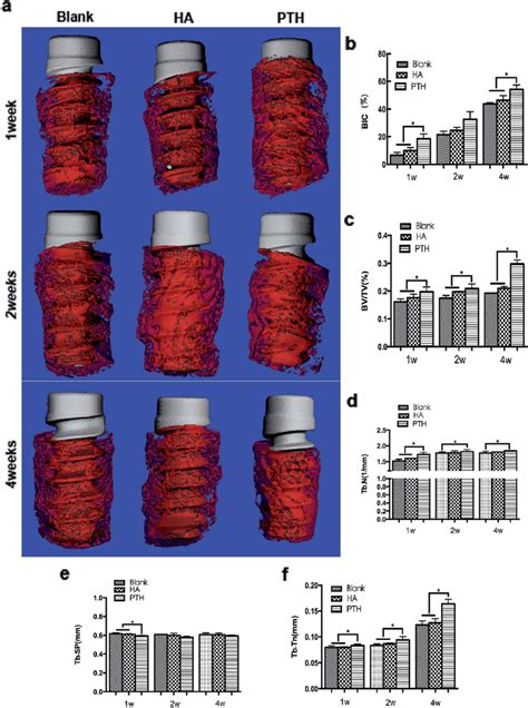 New bone formation observed around the implants with micro-CT. (a) The... | Download Scientific ...