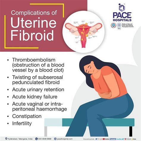 Uterine Fibroids Symptoms Causes Complications And Prevention – NBKomputer