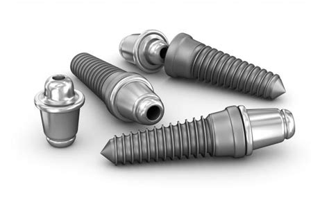 Titanium Dental Implants - Pros and Cons, Prices | Dental Treatment Guide