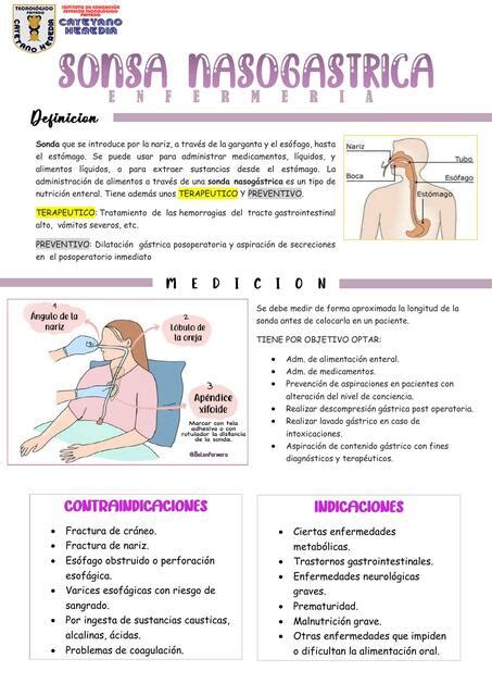 Sonda Nasogástrica Enfermería | Tec. Mariabelen y Stephany | uDocz