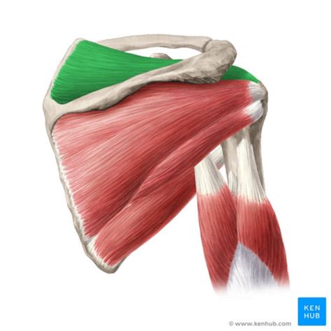 Supraspinatus Tear - Physiopedia