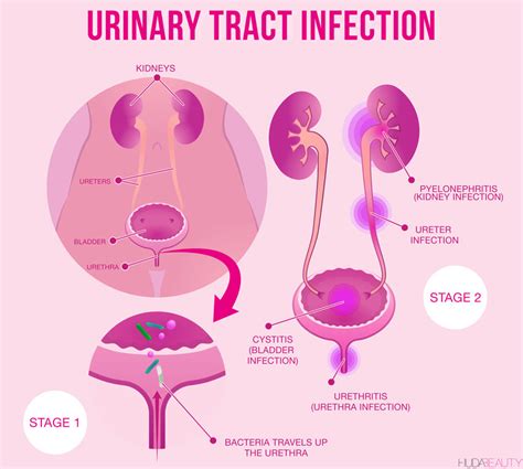 Why You're Getting UTIs And How To Avoid Them | Blog | HUDA BEAUTY