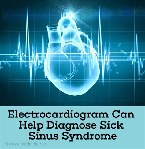 Sick Sinus Syndrome - Causes, Symptoms, Diagnosis, Treatment & Prevention