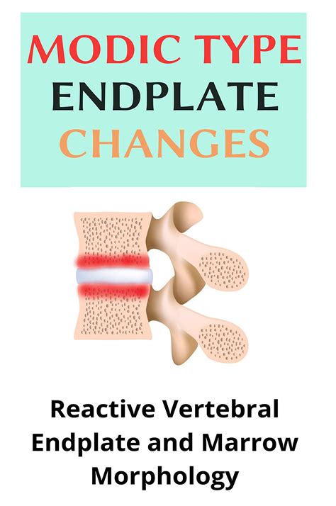 Modic Type Endplate Changes: Reactive Vertebral Endplate And Marrow Morphology: What Causes ...