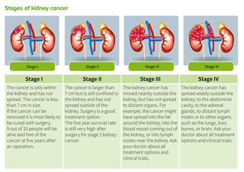 Stage 4 renal cancer | doctorvisit
