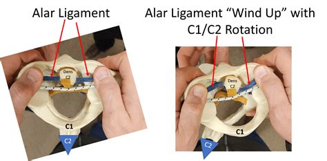 How Does the Body Stabilize the C1-C2 Joint? The Role of the Alar Ligament - Regenexx