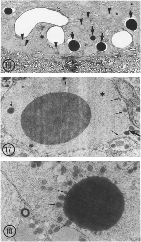 Supraoptic nucleus from a control snake, Natrix maura processed for... | Download Scientific Diagram