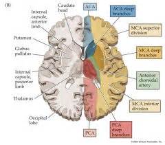 MCA ACA PCA Infarcts Flashcards - Cram.com