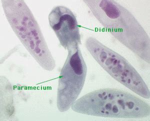 Didinium - microbewiki