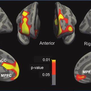 (PDF) Prefrontal cortical thickening after mild traumatic brain injury: a 1-year MRI study