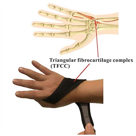 IRUFA,WR-OS-17,Breathable Neoprene Wrist Brace, for TFCC Tear- Triangular Fibrocartilage Complex ...