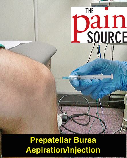 Prepatellar Bursa Aspiration and Injection – Technique and Tips - The ...