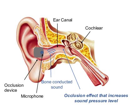 Illustration of the occlusion effect and the anatomy of the ear. | Download Scientific Diagram