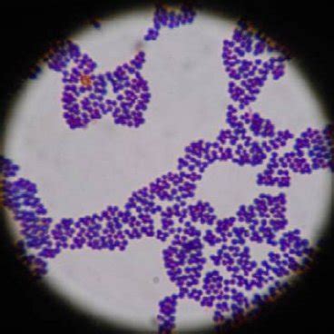 (PDF) Prevalence of Methicillin-Resistant Staphylococcus aureus (MRSA) in Dairy Farms of Pokhara ...