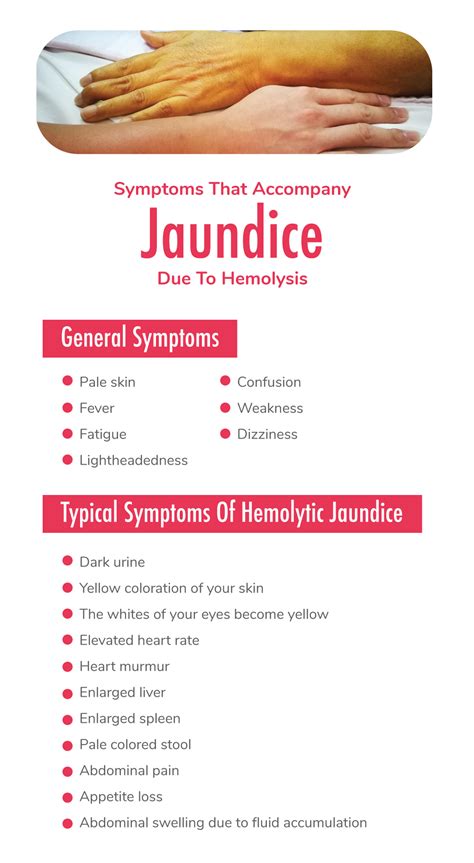 Symptoms, Causes, and Cure for Hemolytic Jaundice - Fatty Liver Disease