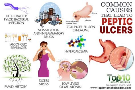 10 Common Causes that Lead to Peptic Ulcers | Top 10 Home Remedies