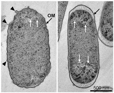 Drug-resistant bacteria flaunt their curves | EurekAlert!