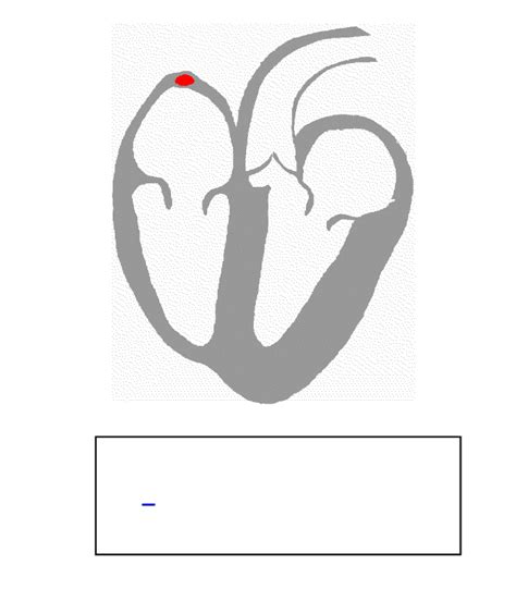 Heart Disease Types and Symptoms; Physiology, Pictures, Video | Healthhype.com