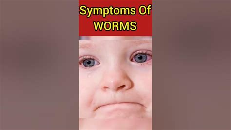 Symptoms Of Worms | Health Tips | #30 | Worms | Worms In Children ...