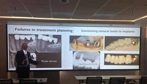 Dental Implant Complications Online Course | Dental Implant ...