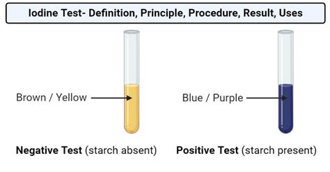 Iodine Test: Principle, Procedure, Result, Uses