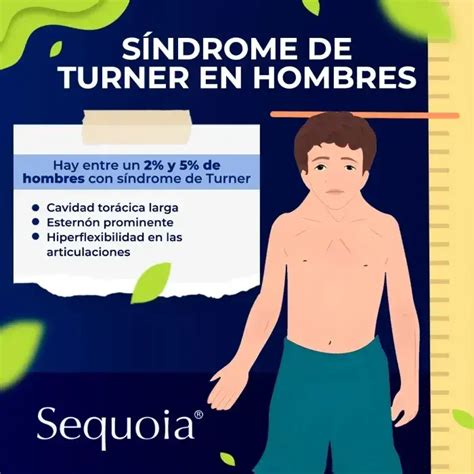 Síndrome de Turner en hombres