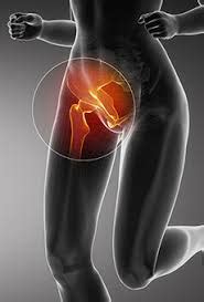 Chronic Groin Pain – More Than Just Osteitis Pubis - Newcastle Sports ...