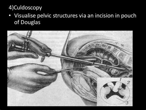 Investigations in gynaecology