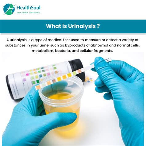 Urinalysis – Healthsoul