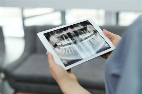 Importance of Dental X-Rays in a Dental Examination