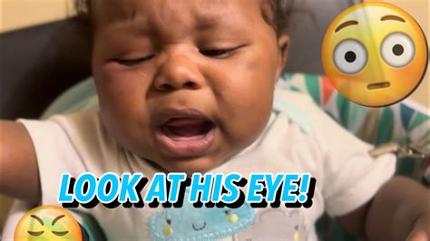 Black Eye Prank on Our Son 😳😳 (he got mad) - YouTube