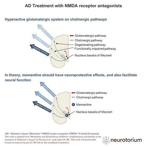 Treatment with NMDA receptor antagonists - Neurotorium