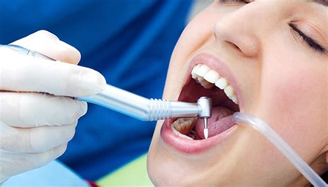 What Is Deep Teeth Cleaning? - Dr. Parul Mehta & Associates