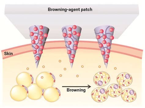 Microneedle skin patch fights fat