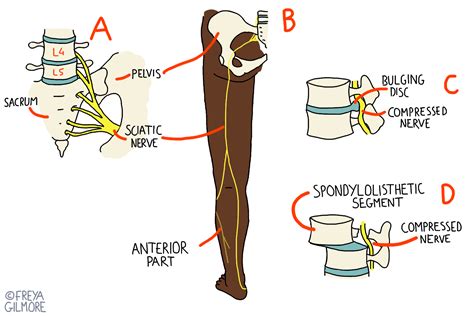 Sciatic Nerve Muscle Innervation