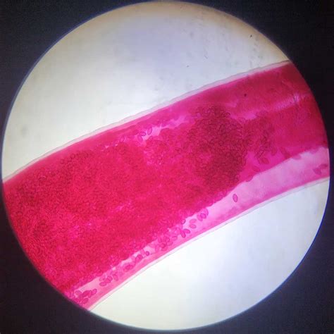 life cycle of trichuris trichiura (whipworm), egg and adult whole mount prepared slides ...