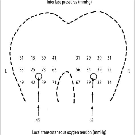 8. The Waterlow scale | Download Table