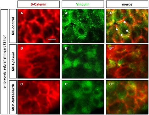 Vinculin does not localize to focal adhesion sites in Paxillin-and... | Download Scientific Diagram