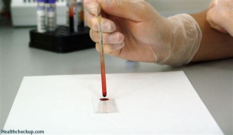 Blood Grouping Test : Principle, Purpose And Procedure | Health Checkup