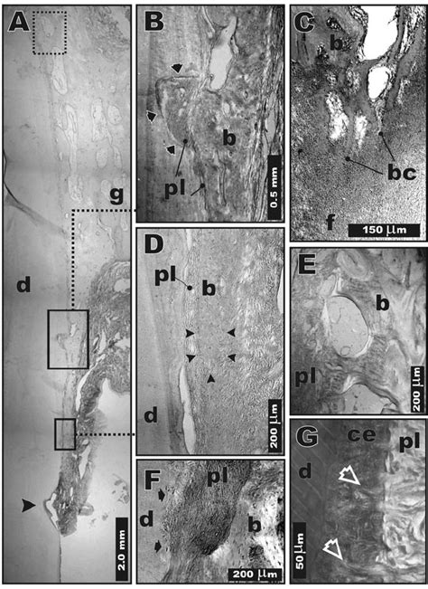 Photomicrographs of treatment site. (A) Bone crest (lower rectangle)... | Download Scientific ...