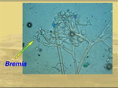 PPT - Phylum : Oomycota Class: Oomycetes PowerPoint Presentation, free download - ID:1178253