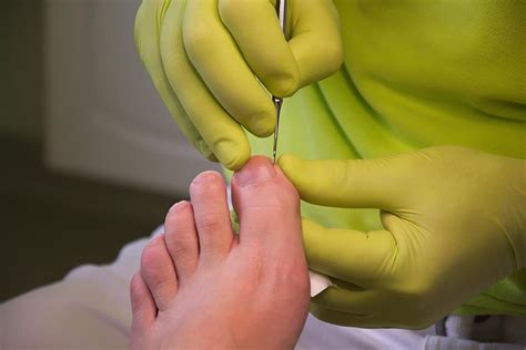 THREE ACTIONS YOU CAN TAKE TO ADDRESS DIABETIC FOOT CARE | Dynamic Foot ...