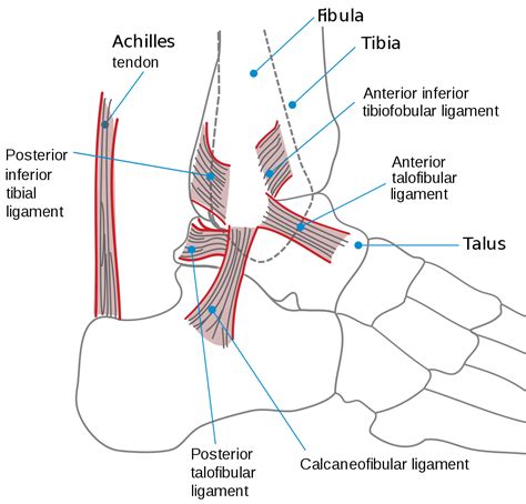 Sprained ankle - Wikipedia